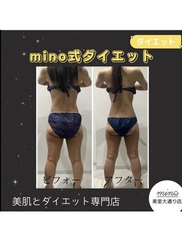 ミノ 美里大通り店(mino)/ダイエットパッケージ