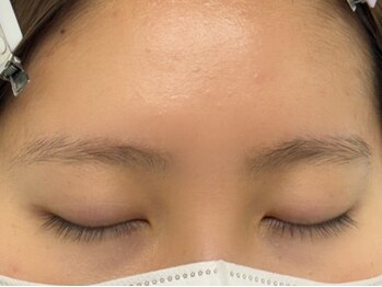 ヘキサ 千葉店(HEXA)/Before★眉毛/美眉スタイリング