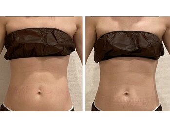 ヨサパーク プレティウム 東海店(YOSA PARK PRETIUM)/お腹周りがスッキリ♪