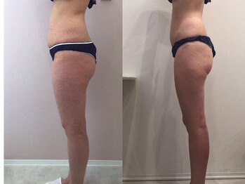 ビラ 銀座店(BILA)/キャビラジ