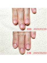 マニブルーム/深爪矯正