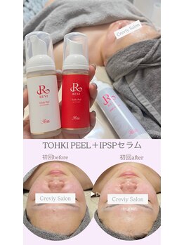 クレヴィー(Creviy)/陶肌ピール1回