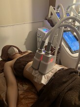 美ネージュ/脂肪冷却