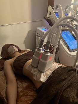 美ネージュ/脂肪冷却