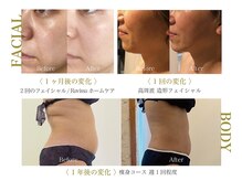 エステティックサロン エスぺランス(ESPERANCE)