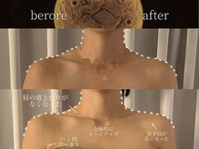 リムーン(REMOON.)/施術後の効果★