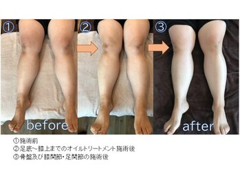 天空ノ虹/◆美脚へ改善