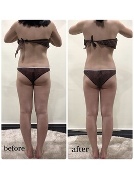 ピーラトゥ 日立(P-Ratu)/上半身集中◎