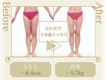 ピュアエステ ブリアント 松戸店/お客様の結果［松戸/痩身］