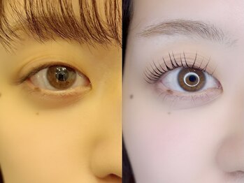 グロウビューティー(grow beauty)の写真/【一重まぶたさんご相談ください】一重瞼でメイクが楽しめない。そんなお悩みに寄り添います◎