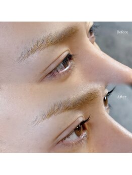 エイティスト(8ist)/メンズラッシュリフト