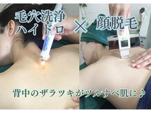 ケイ プレジール/大阪・北浜・背中・毛穴洗浄