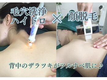 ケイ プレジール/大阪・北浜・背中・毛穴洗浄