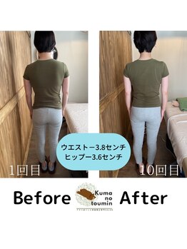 クマの冬眠 高知店/産後ケア