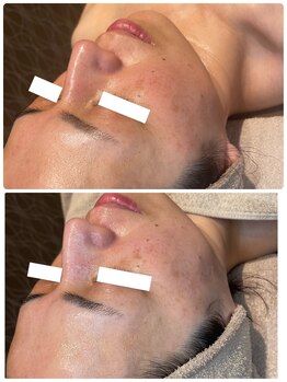 ディオーネ 春日井勝川店(Dione)/マーメイドセルトリートメント