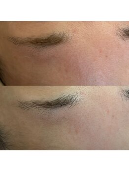 エミュ(e'mu)/ガサガサおでこもつるん♪