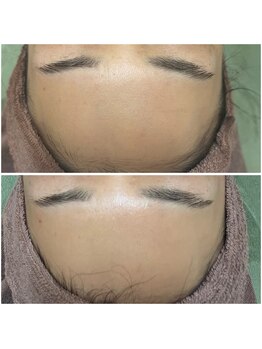 カヌヌ(Kanunu)/プラズマシャワー