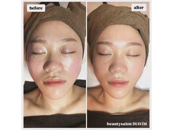 ディアビム(DiAViM)/【頭蓋骨矯正＆コルギ】