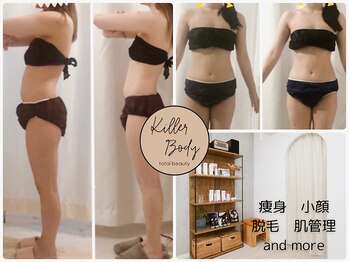 キラーボディ(KILLER BODY)