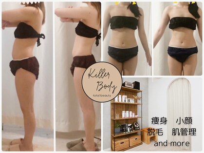 キラーボディ(KILLER BODY)の写真