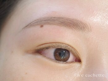 エンカシェット 代官山(En’e cachette)/【矯正美眉】違和感ゼロの印象◎