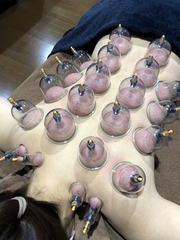 リレス(Riless)の写真/カッピング＋マッサージ50分￥8,000→初回限定￥6,400