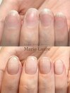 深爪矯正/自爪育成/ネイルケア