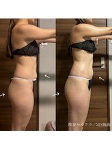 エクラ(eclat)/セルクラ