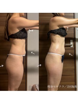 エクラ(eclat)/セルクラ