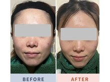 【人気No.1】２０代でも別人級！フェイシャルエステ＋骨格矯正