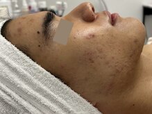 ウェクシー(WECXII)/