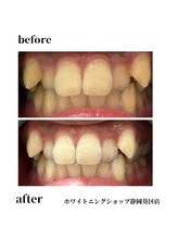 ホワイトニングショップ 葵区静岡駅店/ホワイトニング店ホワイトニング