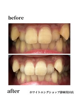 ホワイトニングショップ 葵区静岡駅店/ホワイトニング店ホワイトニング