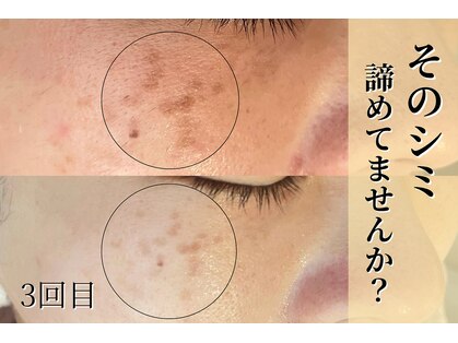 エトレ(etre)の写真