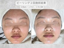 ソワナ(soina)の雰囲気（＜素肌をキレイにする＞豊富な美肌育成メニューで素肌美人に。）
