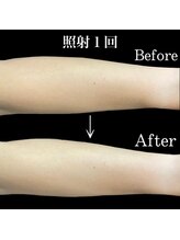 リブ(Lib)/ホワイトシャイン１回目