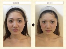 エクシア(ECXIA)/◇コルギ比較写真