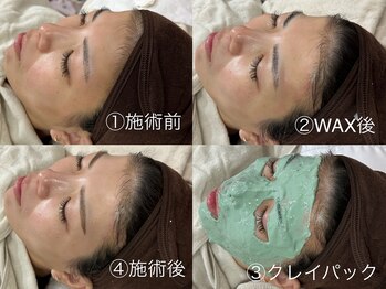 リリー(Lily)/フェイシャルwax＆クレイパック