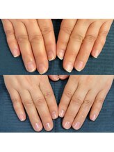 イーネイル(ENAIL)/美フォルム矯正