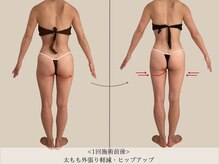 エル 麻布十番(LllL)/【痩身】90分1回の効果