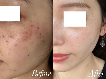 ローズルート(Rose route)/