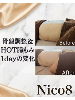 ニコエイト(Nico8)/◇骨盤調整&HOT腸もみ◇