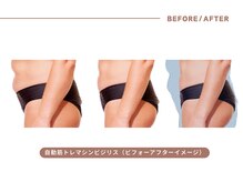 イエス マイサロン(yes My Salon)/自動筋トレマシンBIJIRIS施術例