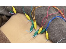 高座渋谷駅鍼灸院 整骨院/大和市/鍼灸/腰痛/高座渋谷