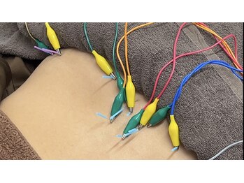 高座渋谷駅鍼灸院 整骨院/大和市/鍼灸/腰痛/高座渋谷