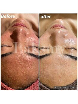 ラクシュミー ナチュラル(Laksmy NATURAL)/お客様ビフォーアフター