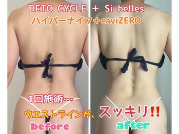 ルミネ(Lumine)/背中・腰回りが気になる方にぜひ