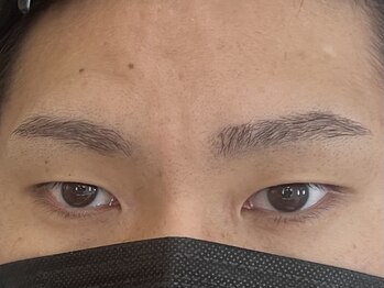 ビューティーガーデン イース/AFTER