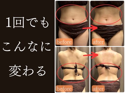おにぎり(ONIGIRI)の写真