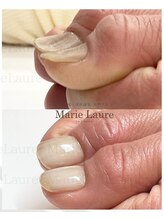 マリーロール 淀屋橋本店(Marie Laure)/自爪育成/深爪矯正/ネイルケア